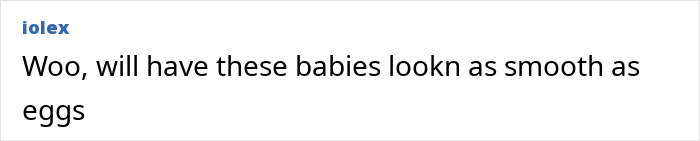 Screenshot of online comment about Scrotox cosmetic trend for men, mentioning smooth appearance like eggs.