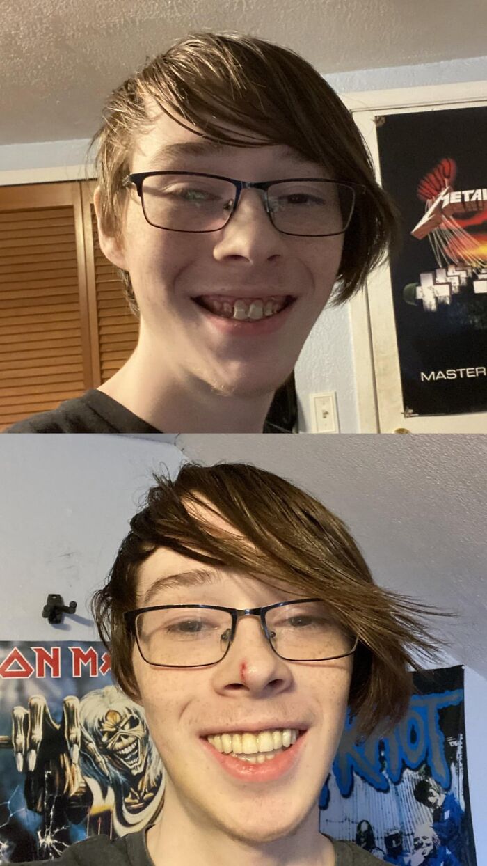 Young man smiling in two selfies with band posters in the background, featured in wholesome posts distraction content.