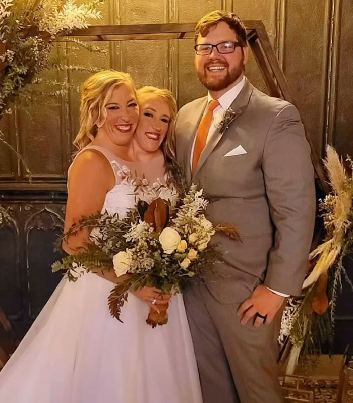 Conjoined Twins Abby And Brittany Finally Break Silence After Photos With Newborn Baby Go Viral