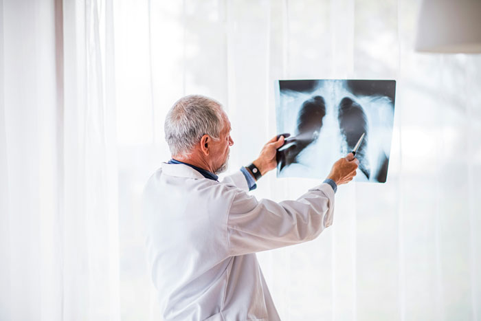 Doctor in white coat examining chest X-ray, relating to testicular cancer and unusual blood test results.