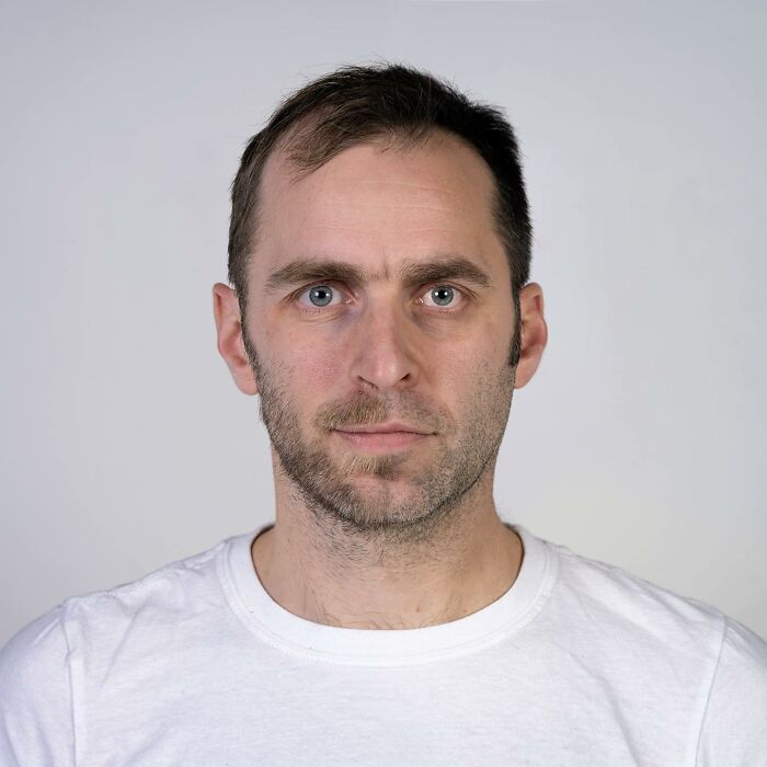 Close-up portrait of a man showcasing genetic features highlighting the strong family DNA connection in side-by-side portraits.