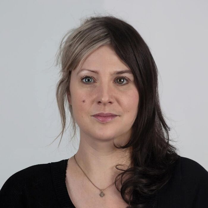 Woman with half blonde, half dark brown hair and mismatched eyes, illustrating strong family DNA traits in a genetic portrait.