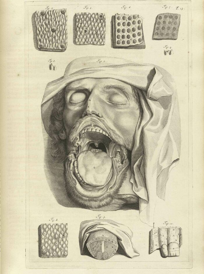 Antique anatomical drawing of a man's head with an open mouth, showing detailed interior structures in a terrifying photo style.