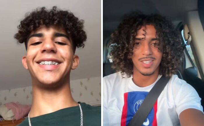 Before and after photo showing an incredible transformation of a young man with curly hair and a bright smile.