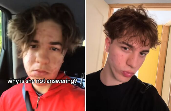Young man showing incredible transformations with improved skin and confidence after deciding to change, before and after photos.