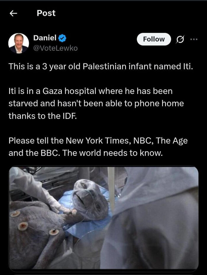 Screenshot of a social media post highlighting an attempt in a Gaza hospital where the universe had different plans.