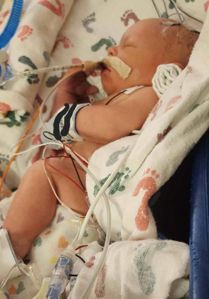 Newborn baby in a hospital incubator with medical tubes and monitoring, showing a challenging parenting moment for dads.