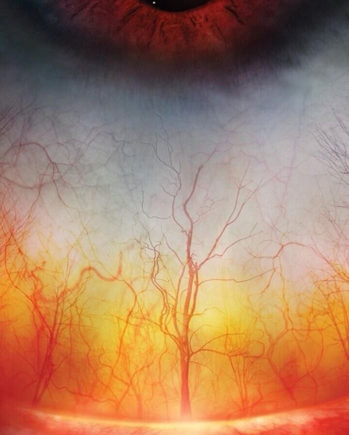 Close-up of an eye with visible rare blood vessel patterns, highlighting surprising details about the human body.