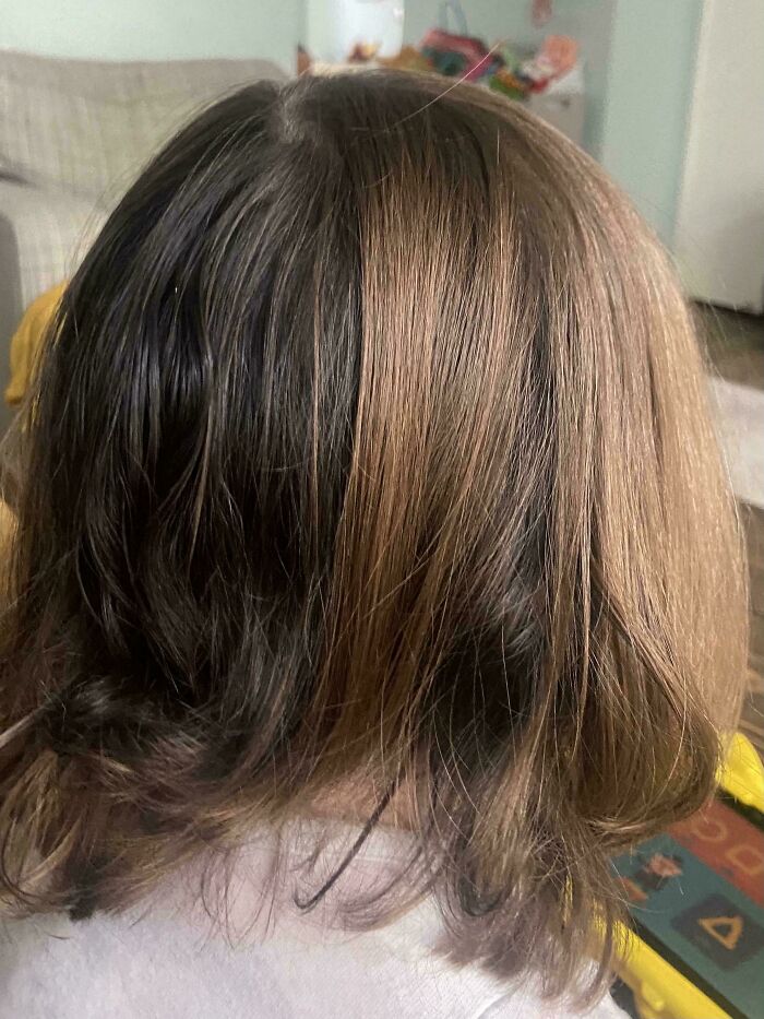 Person with rare and surprising body feature showing half black and half blonde hair in a close-up view.