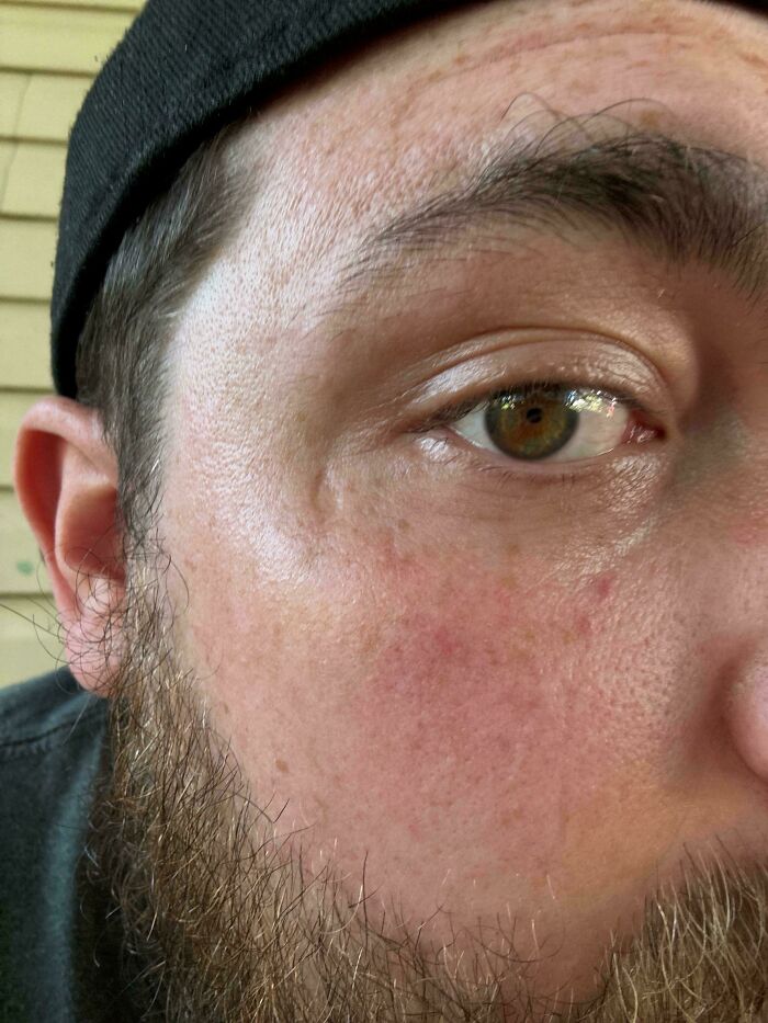Close-up of a man's face showing rare and surprising features of his skin and eye details.