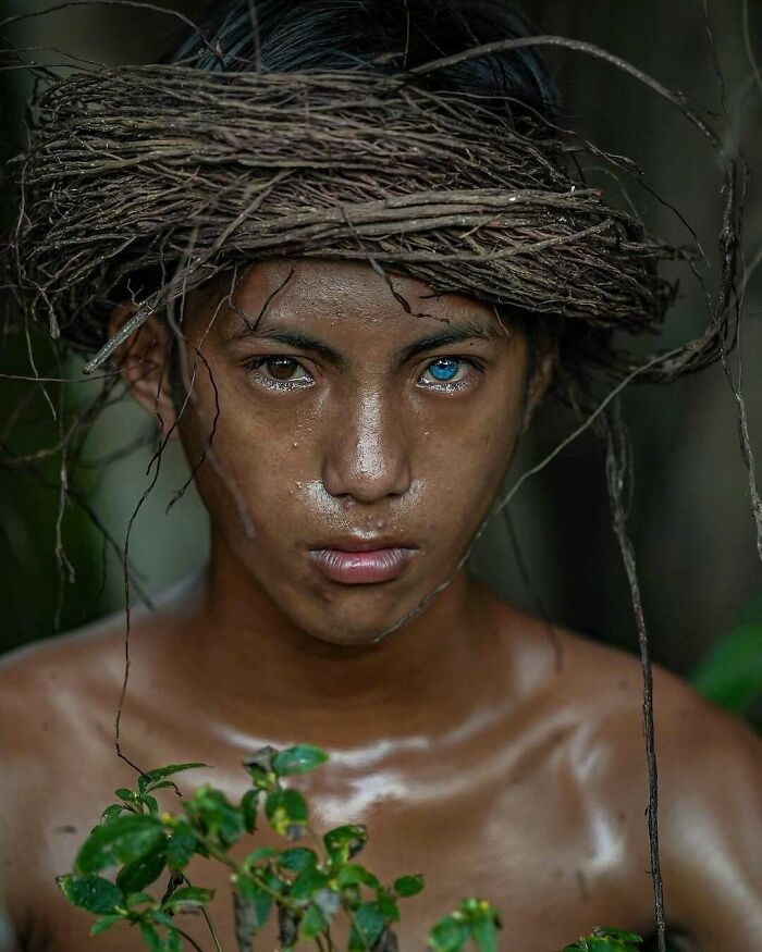 Young person with rare blue eye and natural headpiece, showcasing surprising and rare features of their body.