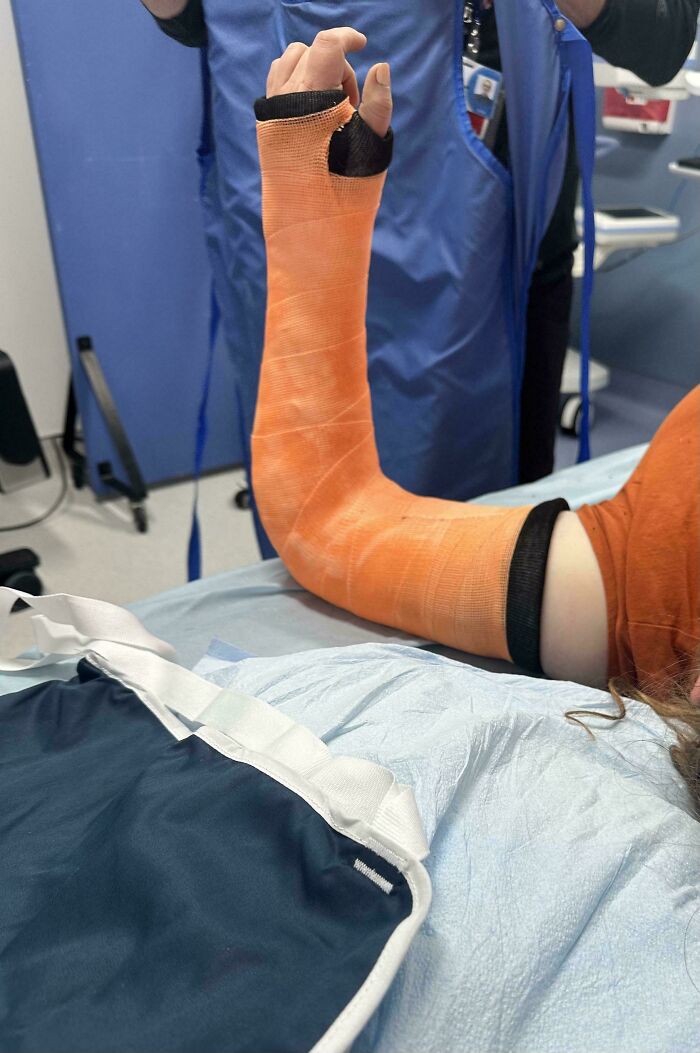 Person in medical setting with broken arm in orange cast showing worst luck on vacation injury.