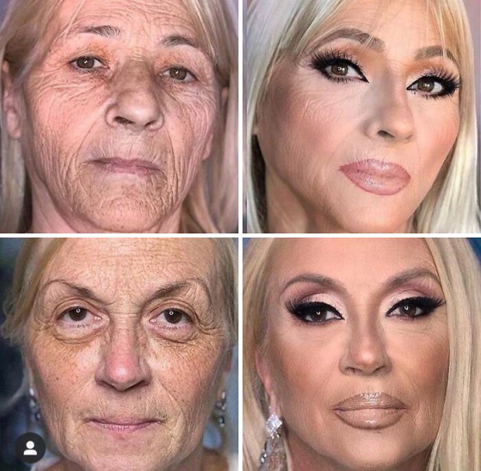 Side-by-side photos showing people trying to fake smooth skin on social media but the filters fool no one.