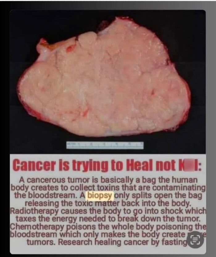 A cancerous tumor with text promoting absurd scientific takes on cancer healing and modern society beliefs.