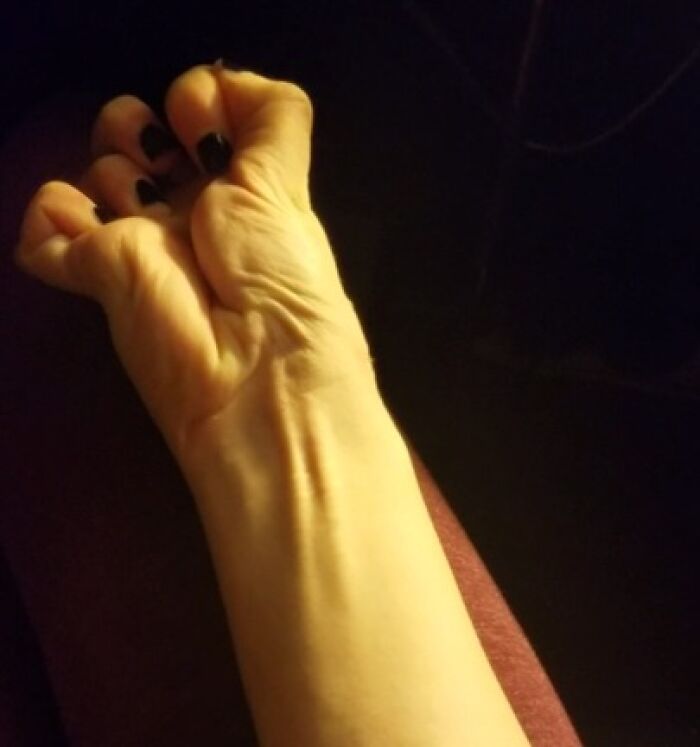 Close-up of a person's hand demonstrating a rare and surprising physical trait of their body in dim lighting.