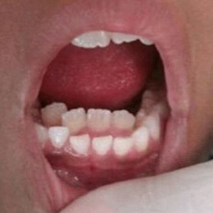 Close-up of a mouth showing rare and surprising body features related to teeth and gums from people’s unique bodies.
