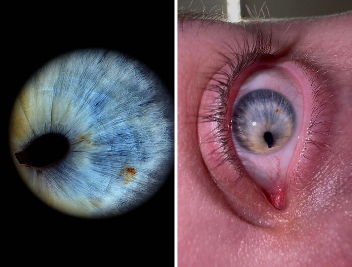 Close-up images showing rare and surprising features of human eyes from people sharing about their bodies.