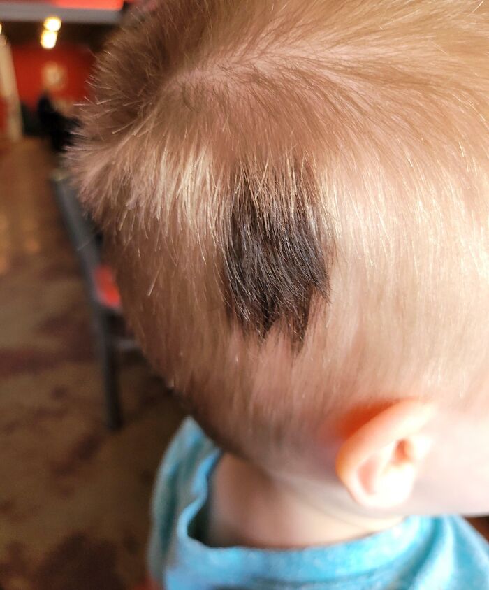 Close-up of a child's head showing a rare and surprising dark patch of hair among light blonde hair.