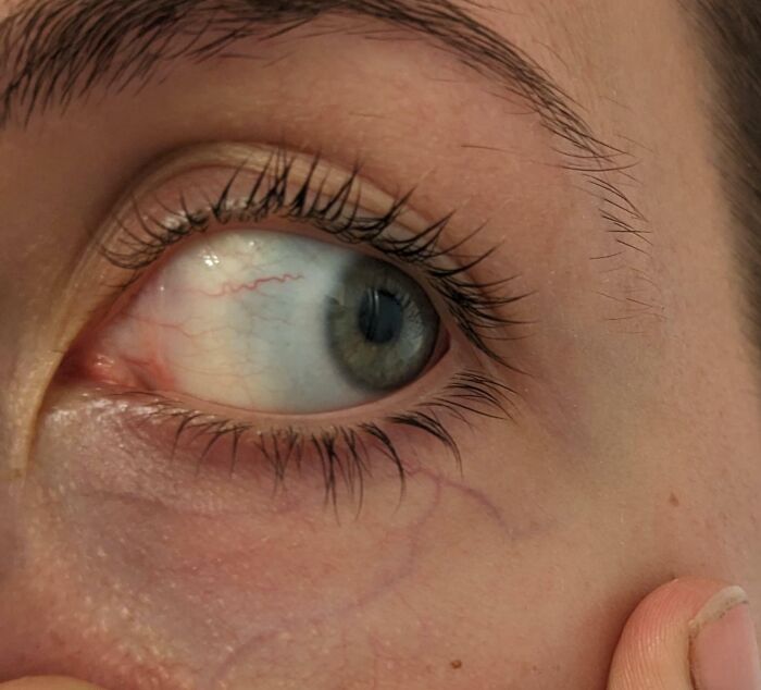 Close-up of a human eye showing rare and surprising details of the body, highlighting unique eye features.