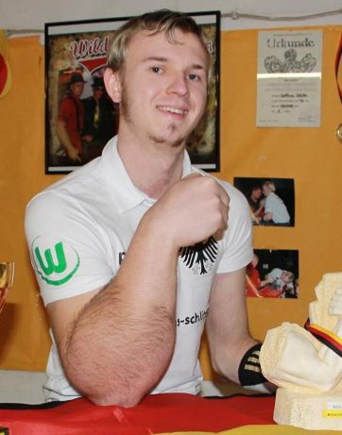 Young man with rare elbow deformity smiling, showcasing a surprising physical condition in a casual indoor setting.
