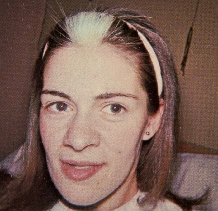 Woman with rare white patch of hair on front of head, showcasing surprising and rare body features from shared pictures.
