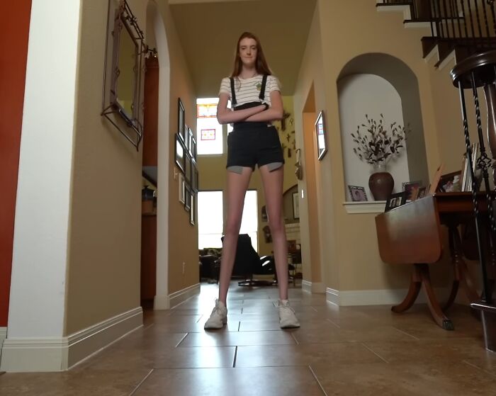 Young woman with rare body features stands confidently in a brightly lit home hallway, showcasing surprising physical traits.