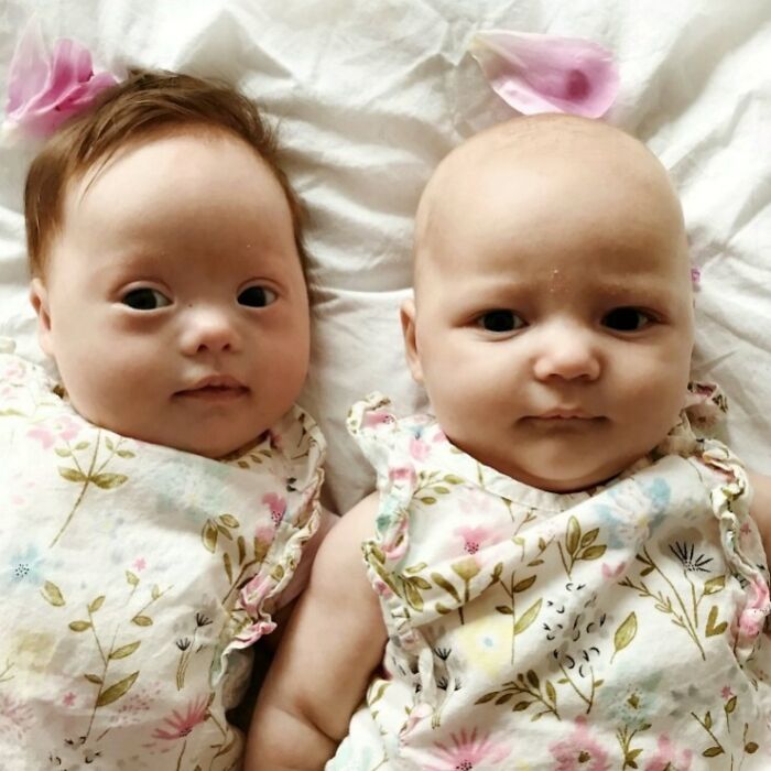 Two babies lying side by side on a white blanket, showcasing rare and surprising things about their bodies.