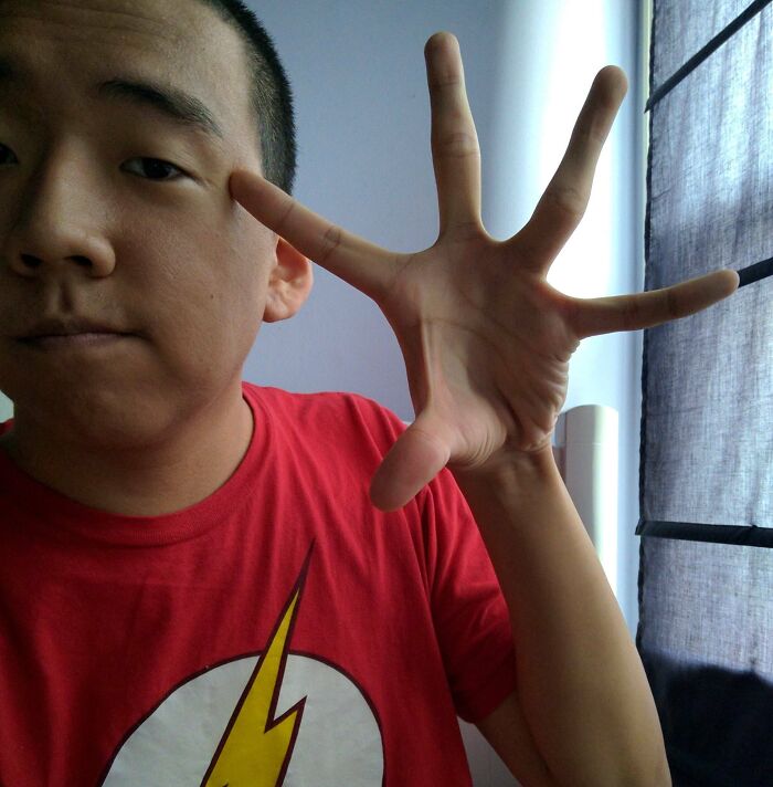 Person wearing a red shirt showing a rare and surprising hand with six fingers against a light background.