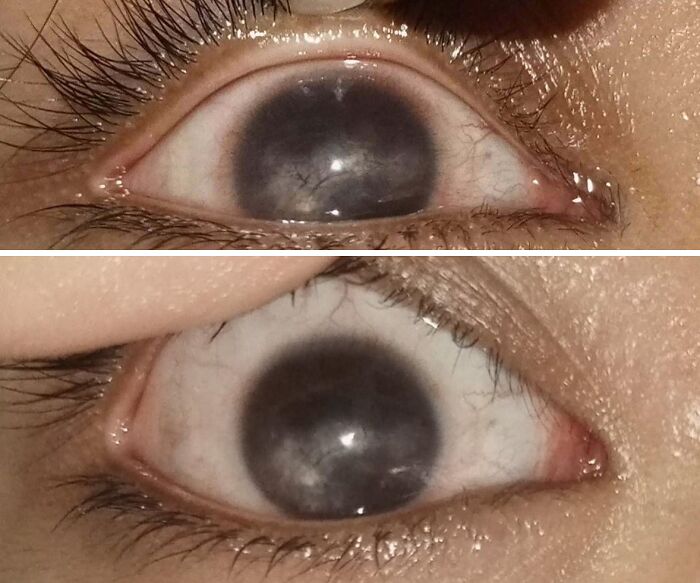 Close-up of an eye showing a rare and surprising body feature with unusual pigmentation and texture.