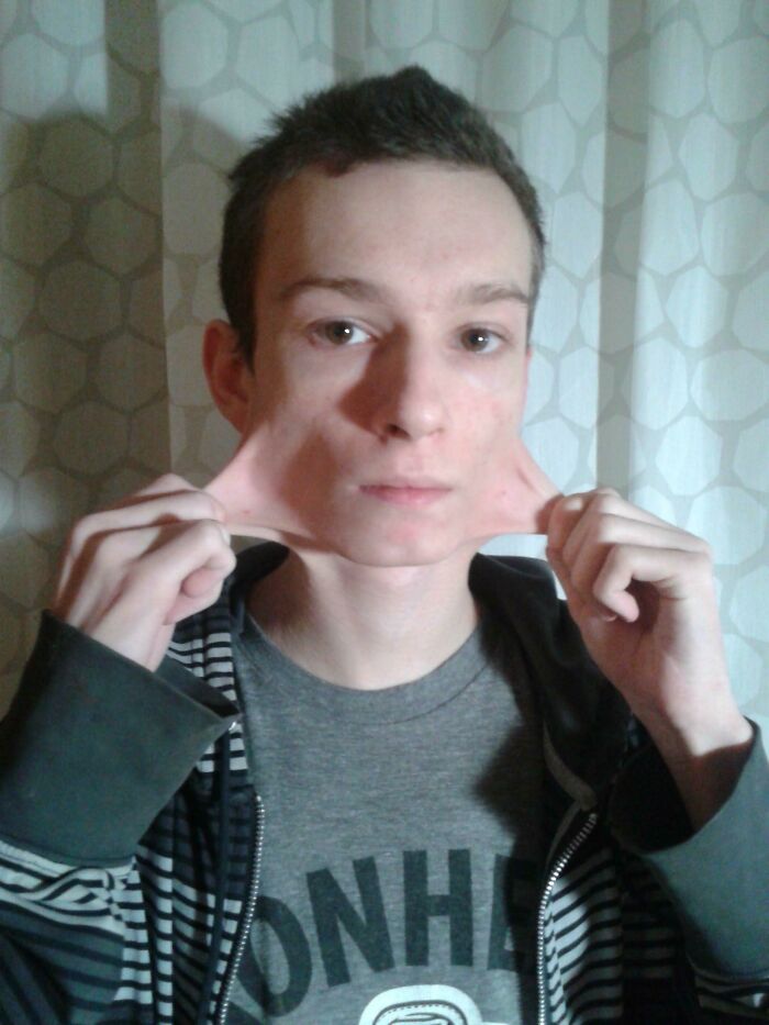 Young man demonstrating rare skin elasticity by stretching the skin on his cheeks, a surprising body feature shared by people.