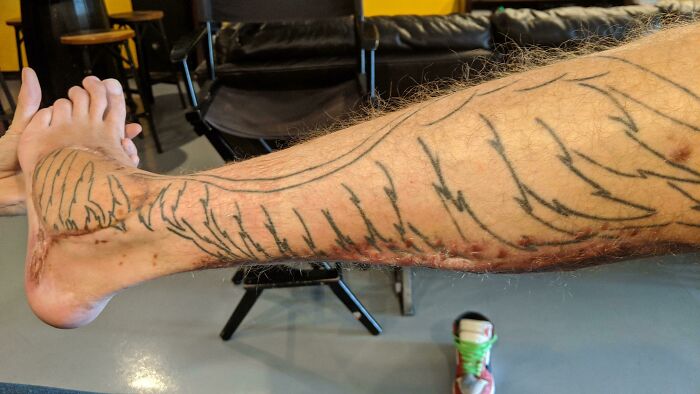 Close-up of a person's leg showing rare and surprising body markings and scars in an indoor setting.