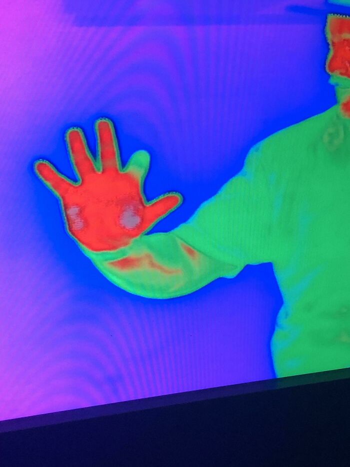 Thermal image showing heat patterns of a person's hand and arm, illustrating rare and surprising body features.