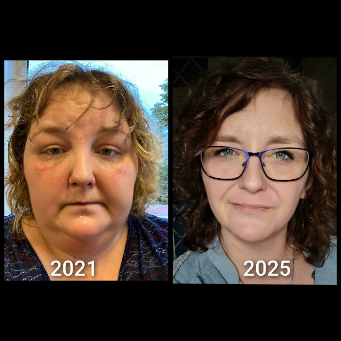 Before and after transformation of a woman from 2021 to 2025 showing a life-changing personal transformation.