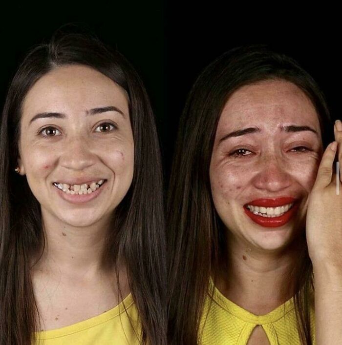 Young woman showing emotional reaction before and after a life-changing transformation revealed in personal stories.