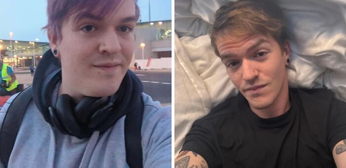 Side-by-side before and after photos showing one of the best glow-ups with improved confidence and appearance.