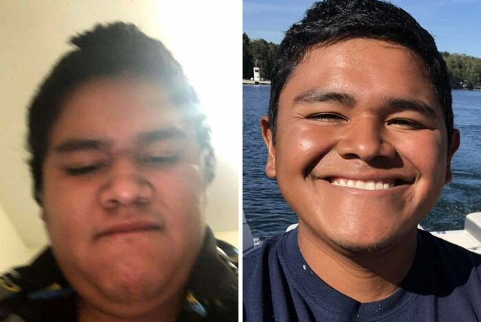 Side-by-side images showing a life-changing transformation with a smiling young man by the water in the after photo.