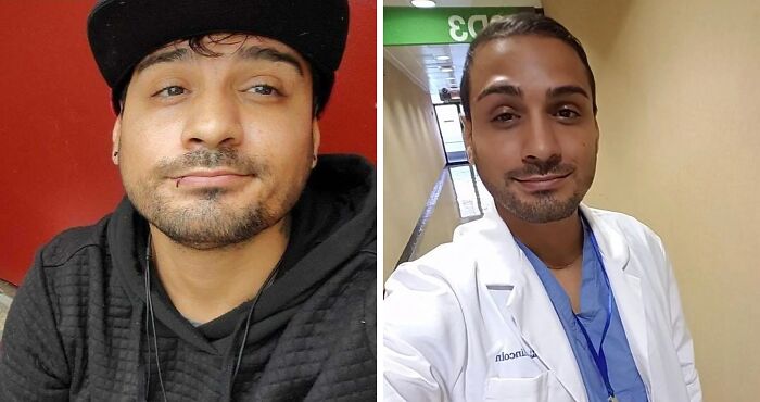 Before and after photos showing a person's transformation that changed their life completely, highlighting life-changing transformations.