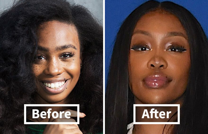 Side-by-side before and after images showing cosmetic transformation and confessions of Sza’s beauty changes. Side-by-side before and after images showing cosmetic transformation and confessions of Sza’s beauty changes.