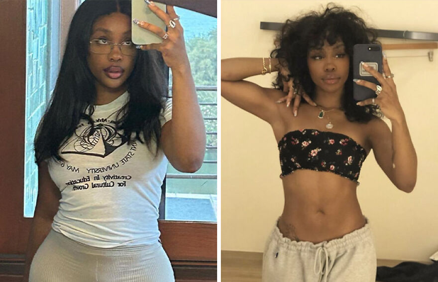 Sza showing a before and after cosmetic transformation selfie, highlighting changes in appearance and style. Sza showing a before and after cosmetic transformation selfie, highlighting changes in appearance and style.
