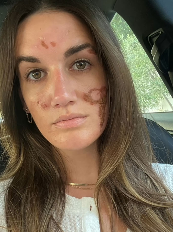 Woman with facial scars sitting in a car, showing damage from a celebrity facialist and costly repairs needed