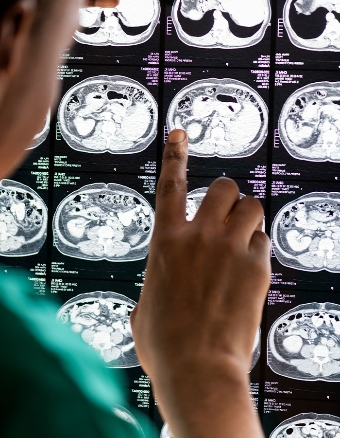 Mom&rsquo;s Google Search Saved Her 6YO Boy When Doctors Couldn&rsquo;t Explain His Collapse, Expert Weighs In