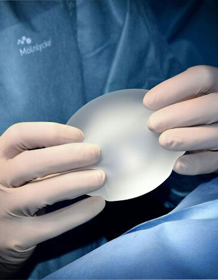 Doctor wearing gloves holding a breast implant during surgery related to fatal breast surgery without father’s consent. Doctor wearing gloves holding a breast implant during surgery related to fatal breast surgery without father’s consent.