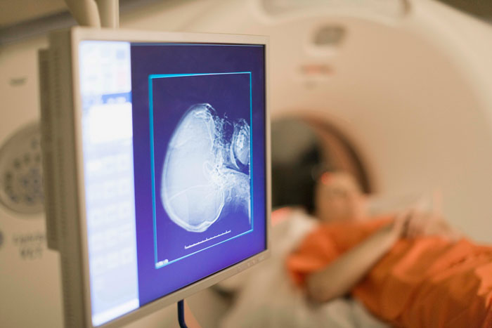 Mom&rsquo;s Google Search Saved Her 6YO Boy When Doctors Couldn&rsquo;t Explain His Collapse, Expert Weighs In