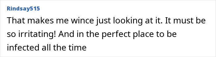 Comment from Rindsay515 expressing discomfort about a dermal piercing on the middle finger, highlighting irritation risks.