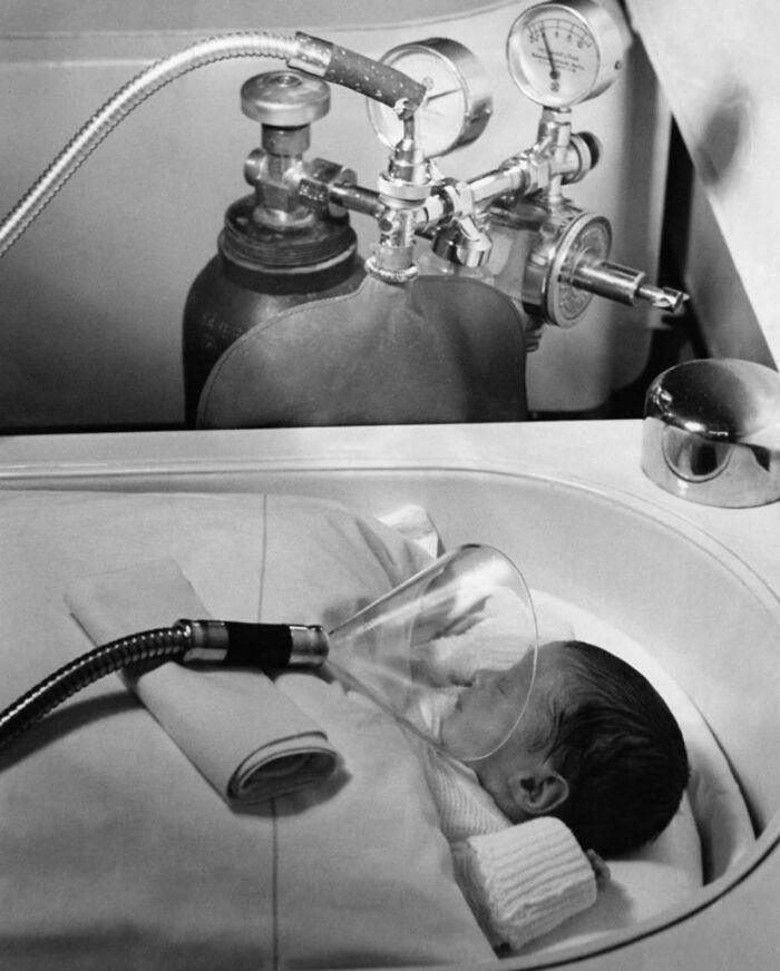 Vintage medical equipment delivering oxygen to a newborn baby, showcasing old-school medical technology and care.
