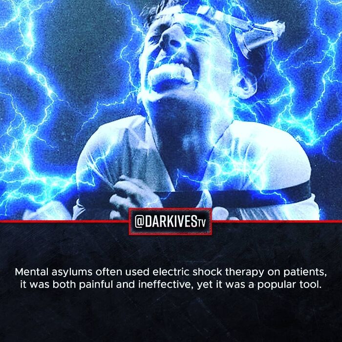 Person in distress receiving electric shock therapy with blue lightning effects illustrating dark and strange facts.