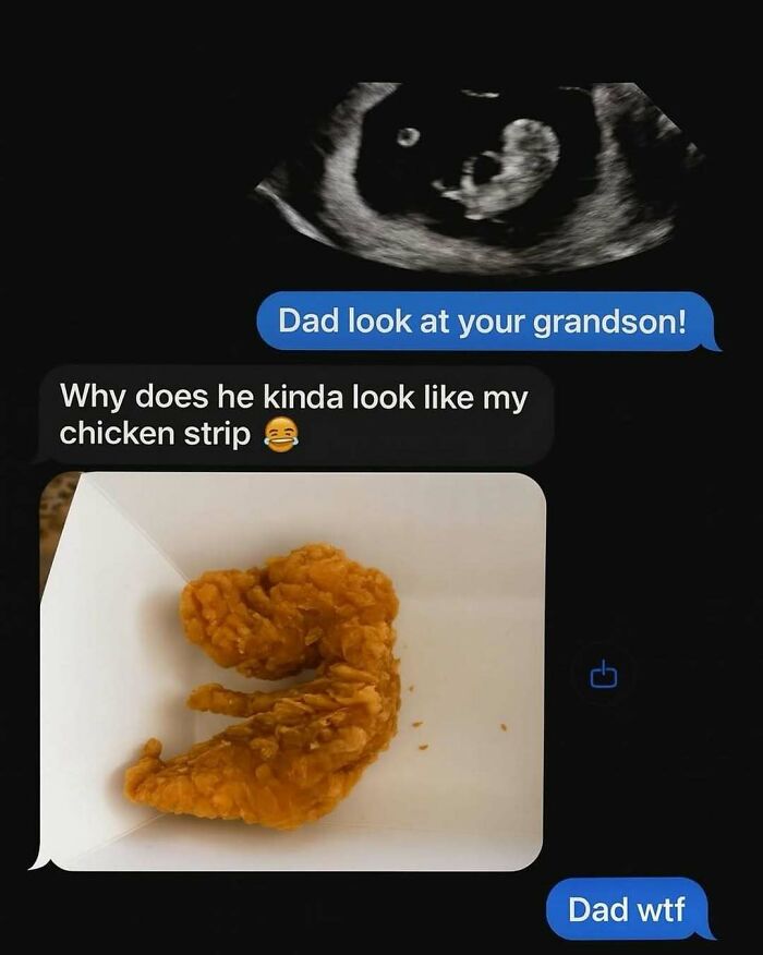 Ultrasound image text meme comparing a fetus to a chicken strip capturing humor in working in medicine.