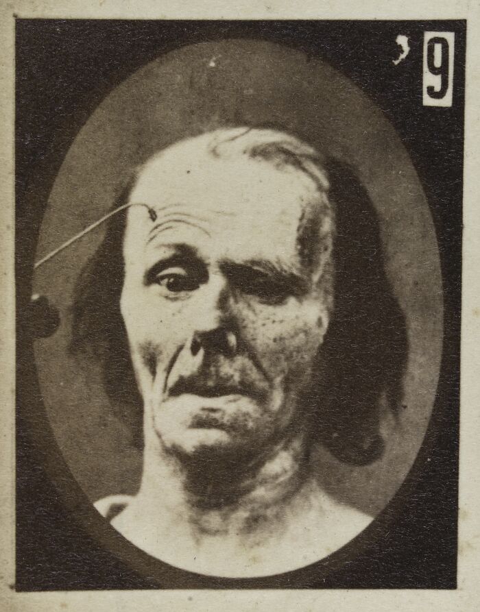 Black and white 19th century facial expressions experiment showing distorted and eerie human face emotions.