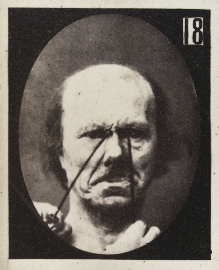 Black and white 19th century facial expressions experiment photo showing a man with intense, manipulated facial muscles.