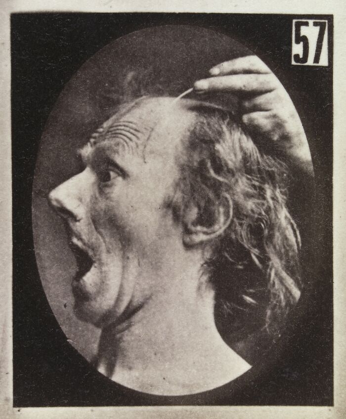 Black and white 19th century facial expressions experiment showing a man with a shocked expression and raised hand near head.